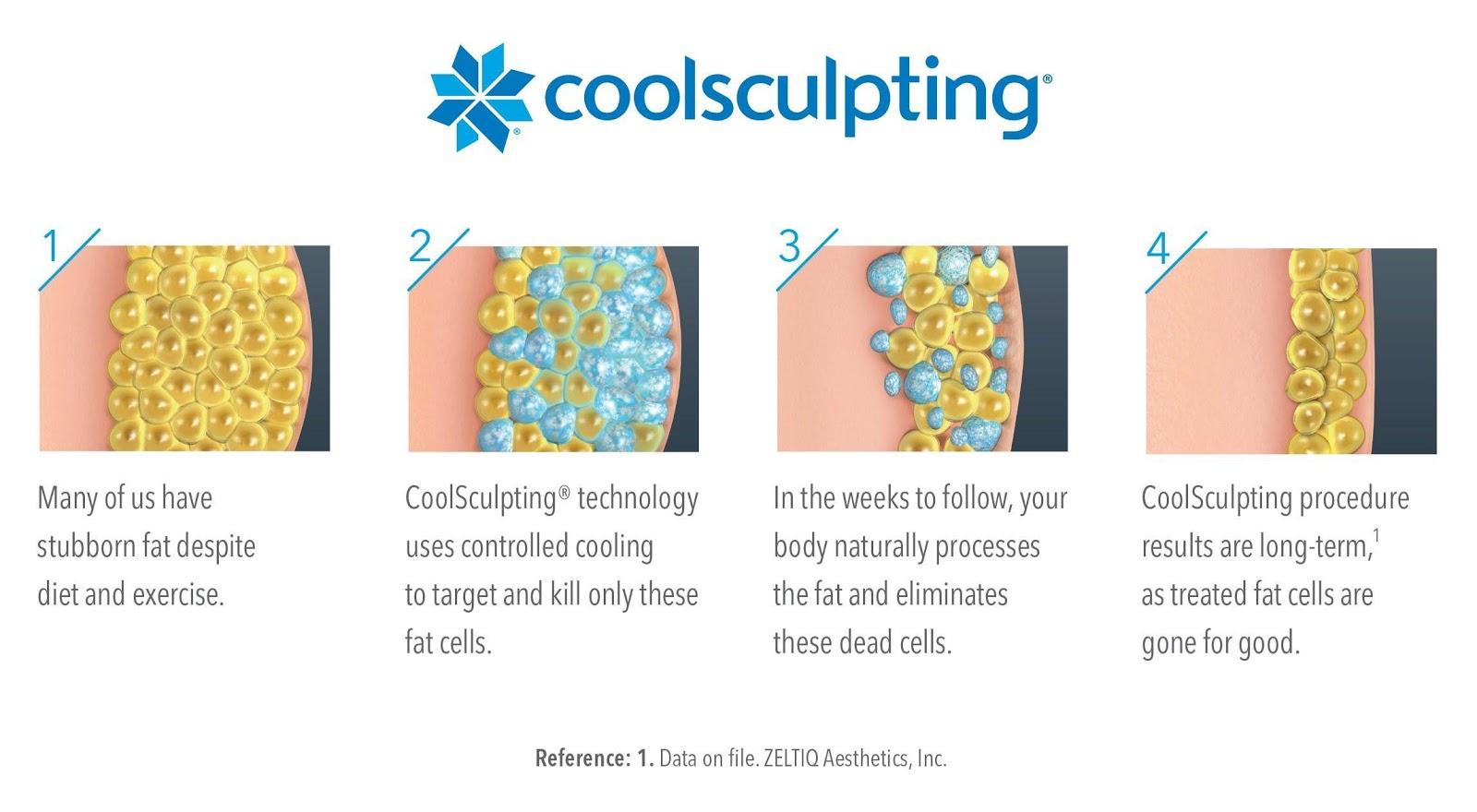 how does coolsculpting work